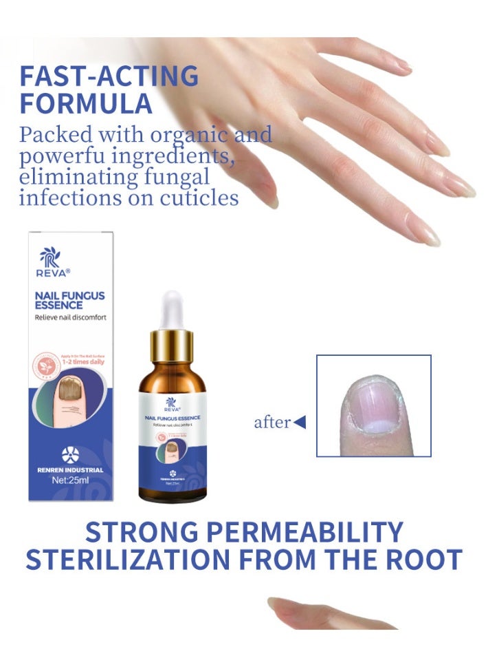 ريفا محلول ريفا لعلاج فطريات الأظافر ومضاد للبكتيريا: إصلاح احترافي موجه، اختراق عميق، يحسن مشاكل فطريات الأظافر (30 مل) - Image 5